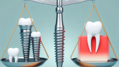 أسرار الحصول على أسعار زراعة الأسنان الفورية المناسبة لميزانيتك